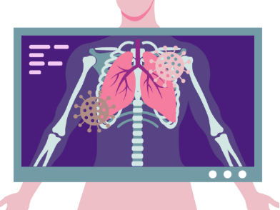 Recomendaciones infección respiratoria adultos