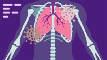 Recomendaciones infección respiratoria adultos