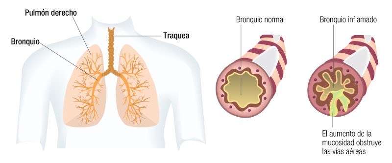 Ilustración de pulmón, bronquio y tráquea